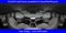 2026 Ford Explorer Platinum In-Transit